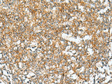 Immunohistochemistry of paraffin-embedded Human tonsil tissue using RAB13 Polyclonal Antibody at dilution of 1:50(×200)