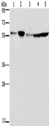 Anti-Human NUP50 Antibody - ABMIUM
