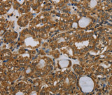 Anti-Human/Mouse PARP8 Antibody - ABMIUM