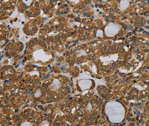 Anti-Human/Mouse PARP8 Antibody