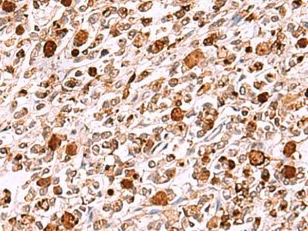 Anti-Human/Mouse INO80 Antibody