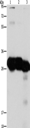 Anti-Human/Mouse KHK Antibody - ABMIUM