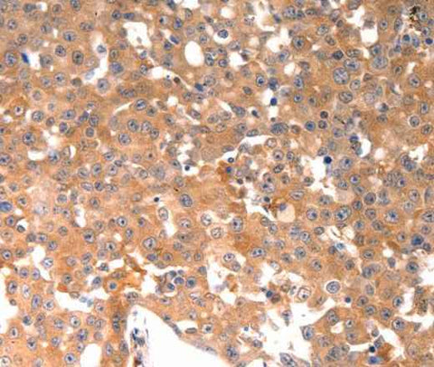 Anti-Human BGLAP Antibody