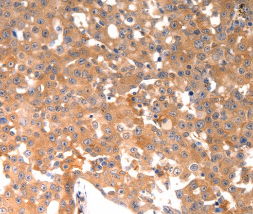 Anti-Human BGLAP Antibody - ABMIUM