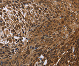 Anti-Human/Mouse DCP1A Antibody - ABMIUM