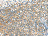 Immunohistochemistry of paraffin-embedded Human tonsil tissue using TTLL1 Polyclonal Antibody at dilution of 1:60(×200)