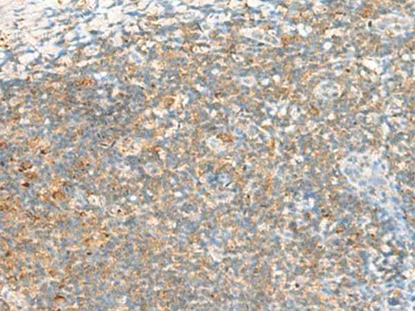 Anti-Human/Mouse/Rat TTLL1 Antibody