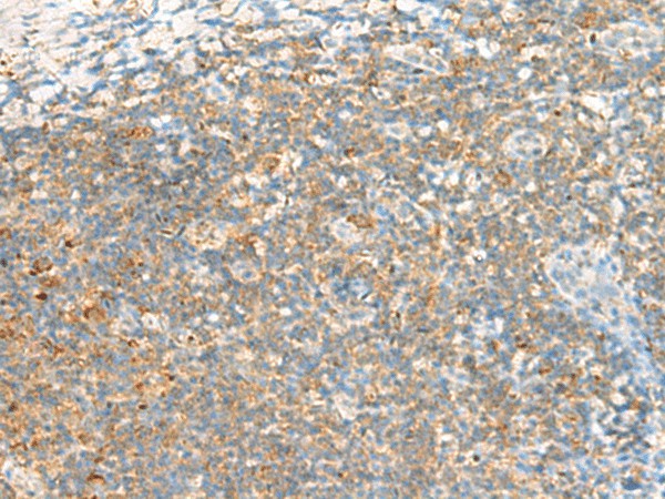 Immunohistochemistry of paraffin-embedded Human tonsil tissue using TTLL1 Polyclonal Antibody at dilution of 1:60(×200)
