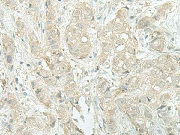 Anti-Human/Mouse MIEN1 Antibody