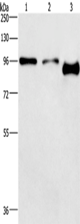 Anti-Human/Mouse/Rat PIP5K1C Antibody - ABMIUM