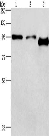 Anti-Human/Mouse/Rat PIP5K1C Antibody - ABMIUM