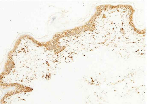 Anti-Human CD44 Antibody [A864] - ABMIUM