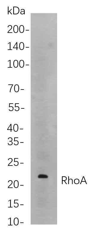 Anti-Human/Mouse/Rat RhoA Antibody [B868] - ABMIUM