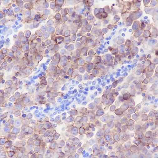 Anti-Human c-Kit Antibody [A186] - ABMIUM