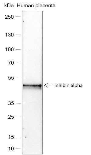 Anti-Human Inhibin alpha Antibody [A266] - ABMIUM