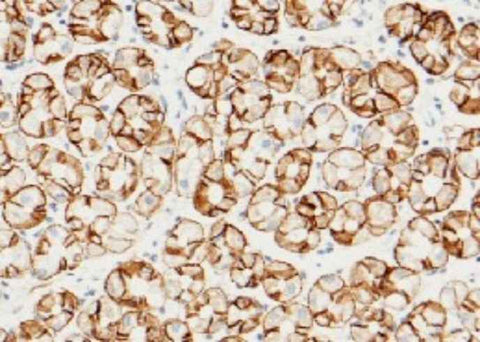 Anti-Human CA9 Antibody [A1291] - ABMIUM