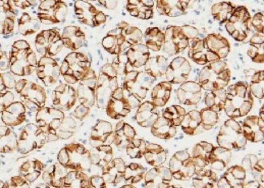 Anti-Human CA9 Antibody [A1291] - ABMIUM