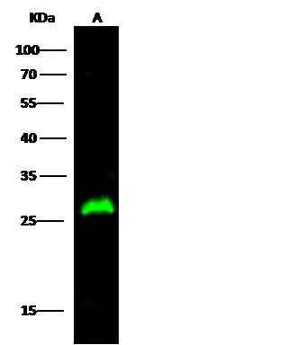 Anti-Mouse HPGD Antibody [B461] - ABMIUM