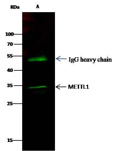 Anti-Human METTL1 Antibody [A968] - ABMIUM