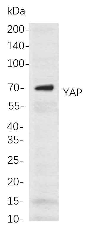 Anti-Human/Mouse/Rat YAP Antibody [B802] - ABMIUM