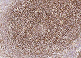 Anti-Human VCAM1 Antibody [A1018] - ABMIUM