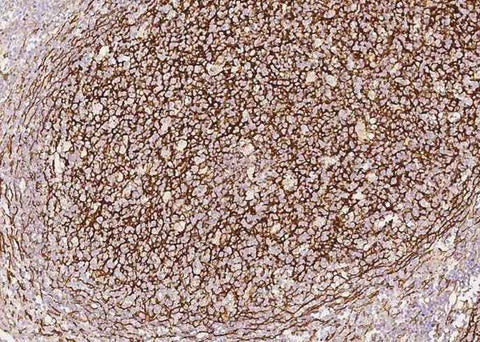 Anti-Human VCAM1 Antibody [A1018] - ABMIUM