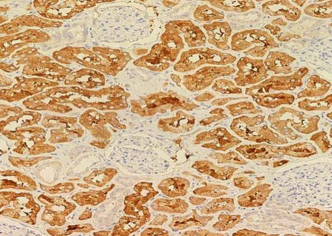 Anti-Human FUT4 Antibody [A934] - ABMIUM