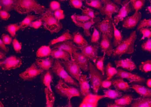 Anti-Human SPARCL1 Antibody [A1148] - ABMIUM