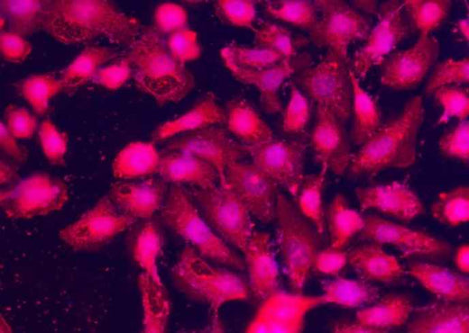 Anti-Human SPARCL1 Antibody [A1148] - ABMIUM
