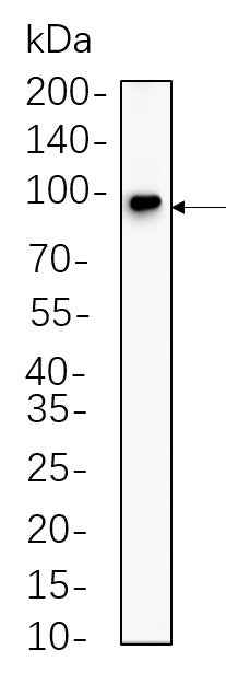 Anti-Human/Mouse/Rat/Pig Insulin Receptor β Antibody [B615] - ABMIUM