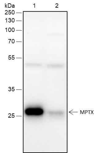 Anti-Mouse MPTX Antibody [A306] - ABMIUM