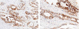 Anti-Human CDH17 Antibody [A967] - ABMIUM