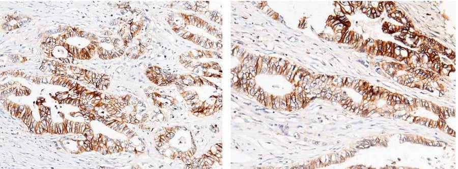 Anti-Human CDH17 Antibody [A967] - ABMIUM