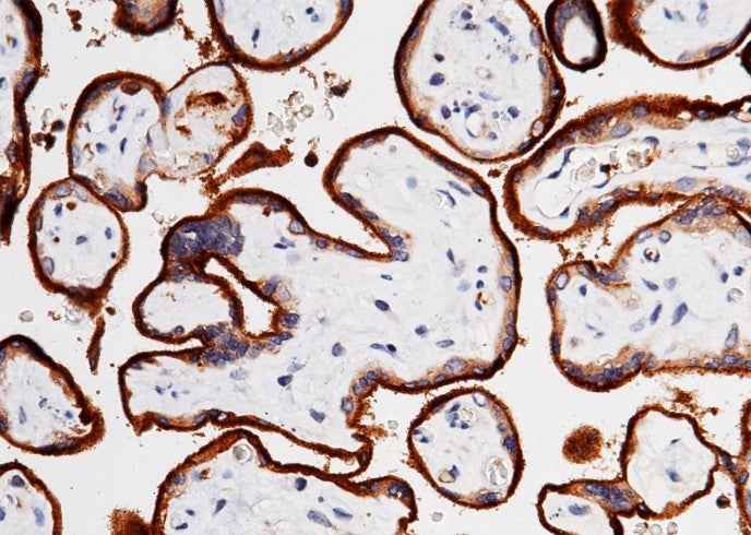 Anti-Human TFRC Antibody [B283] - ABMIUM
