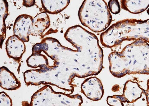 Anti-Human TFRC Antibody [B283] - ABMIUM