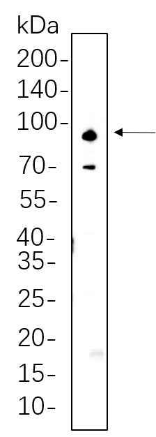 Anti-Human/Mouse/Rat ADAM10 Antibody [B568] - ABMIUM