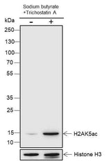 Anti-Human/Rat/Mouse Histone H2A (Acetyl Lys5) Antibody [A109]