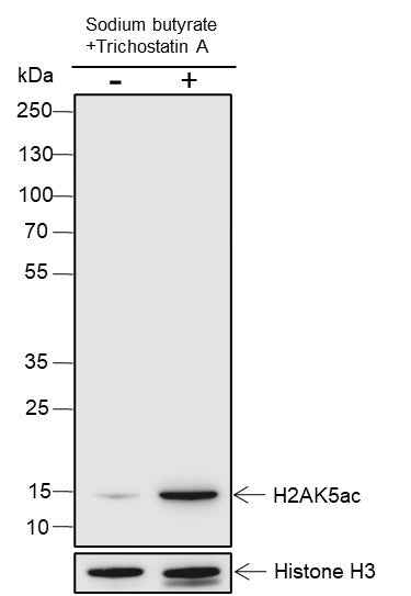 Anti-Human/Rat/Mouse Histone H2A (Acetyl Lys5) Antibody [A109]