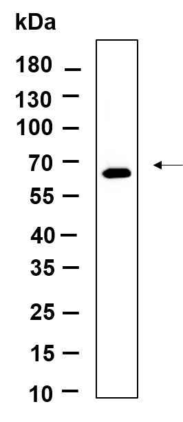Anti-Mouse/Rat PERK Antibody [B1155] - ABMIUM