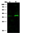 Anti-Human IFNAR2 Antibody [A948] - ABMIUM