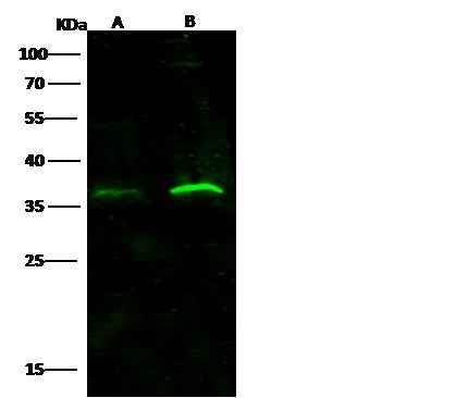 Anti-Human IFNAR2 Antibody [A948] - ABMIUM