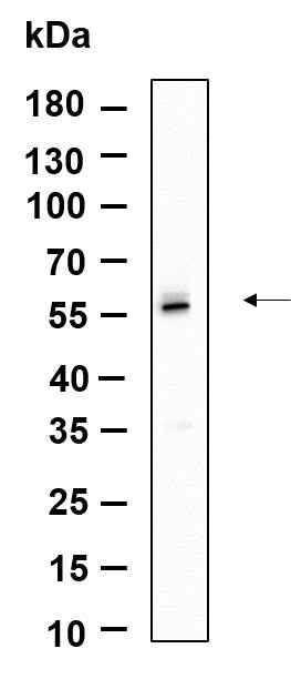 Anti-Human/Mouse/Rat TRAF2 Antibody [B931] - ABMIUM