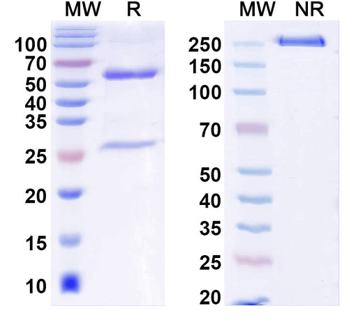 SDS-PAGE for Anti-ANO5/TMEM16E Antibody (N421A/36)