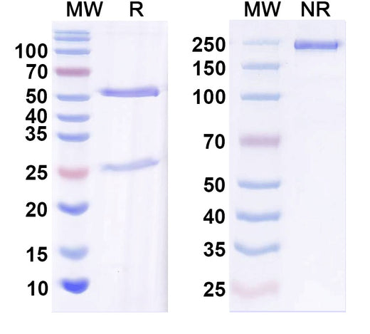 SDS-PAGE for Anti-Beta1-spectrin Antibody (N385/16)