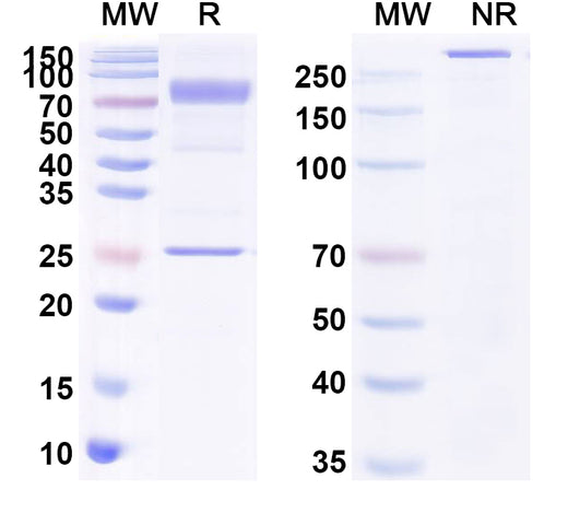 SDS-PAGE for Anti-CHIKV Spike glycoprotein E2 Antibody (5F10)