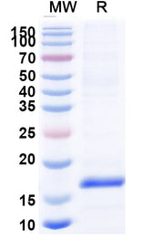 SDS-PAGE for Anti-Clostridium botulinum botA/BOTOX VHH (SAA0935)
