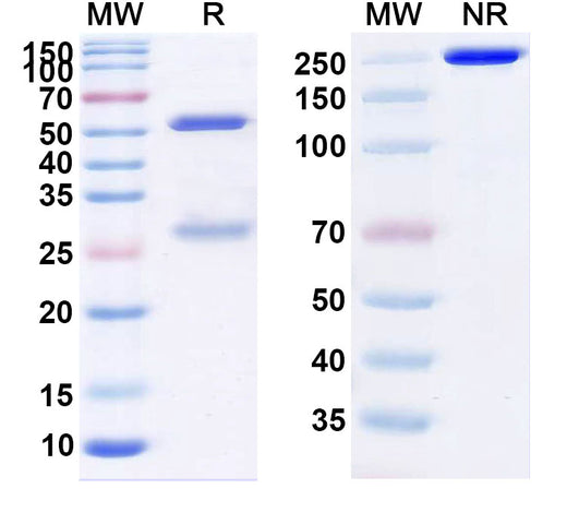 SDS-PAGE for Anti-Clostridium perfringens CPE Antibody (SAA2357)