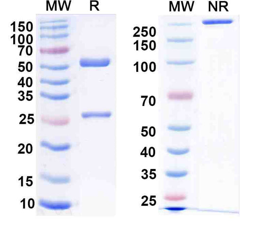Anti-DENV-2 E-DII/Envelope Protein E Antibody (2A10)