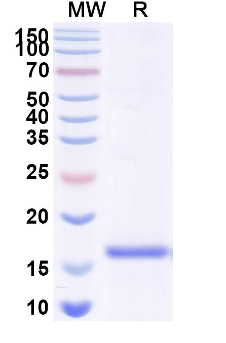 SDS-PAGE for Anti-GFP VHH (SAA0976)