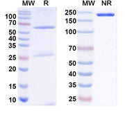 SDS-PAGE for Anti-Haemophilus influenzae ompP1 Antibody (SAA1426)